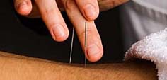Acupuncture Website Design | Photographs and Images #05